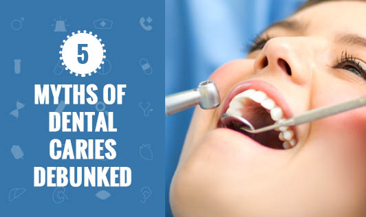 5 Myths of Dental Caries Debunked