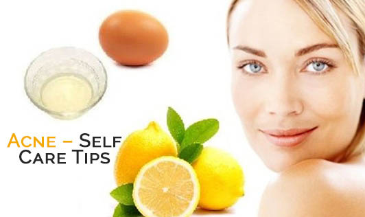 Acne – Self Care Tips