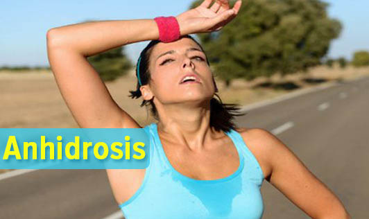 Anhidrosis - The Wellness Corner