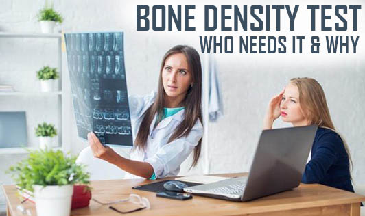 Bone Density Test - Who Needs It & Why