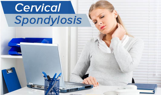 Cervical Spondylosis