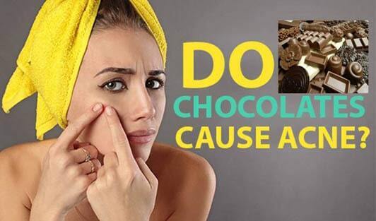 Can Chocolate-Binging Cause You Acne Trouble? - The Wellness Corner