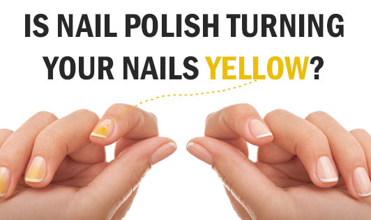 50+ Gorgeous Yellow Acrylic Nails to Spice Up Your Fashion - The Cuddl |  Short gel nails, Yellow nails, Gel nails