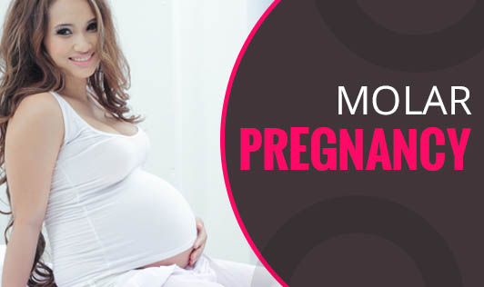 Molar Pregnancy