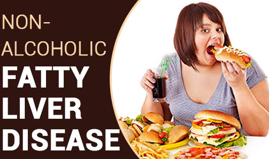 Non-alcoholic Fatty Liver Disease 