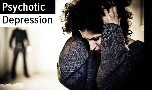 Psychotic Depression