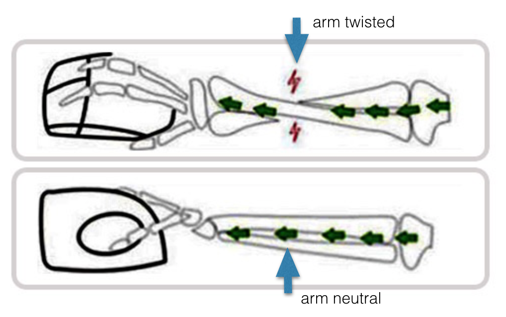 Benefits of an Ergonomic Mouse - The Wellness Corner